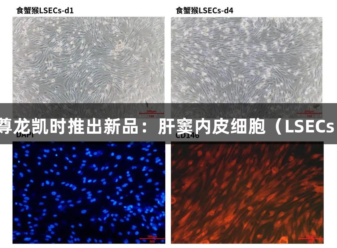 尊龙凯时推出新品：肝窦内皮细胞（LSECs）