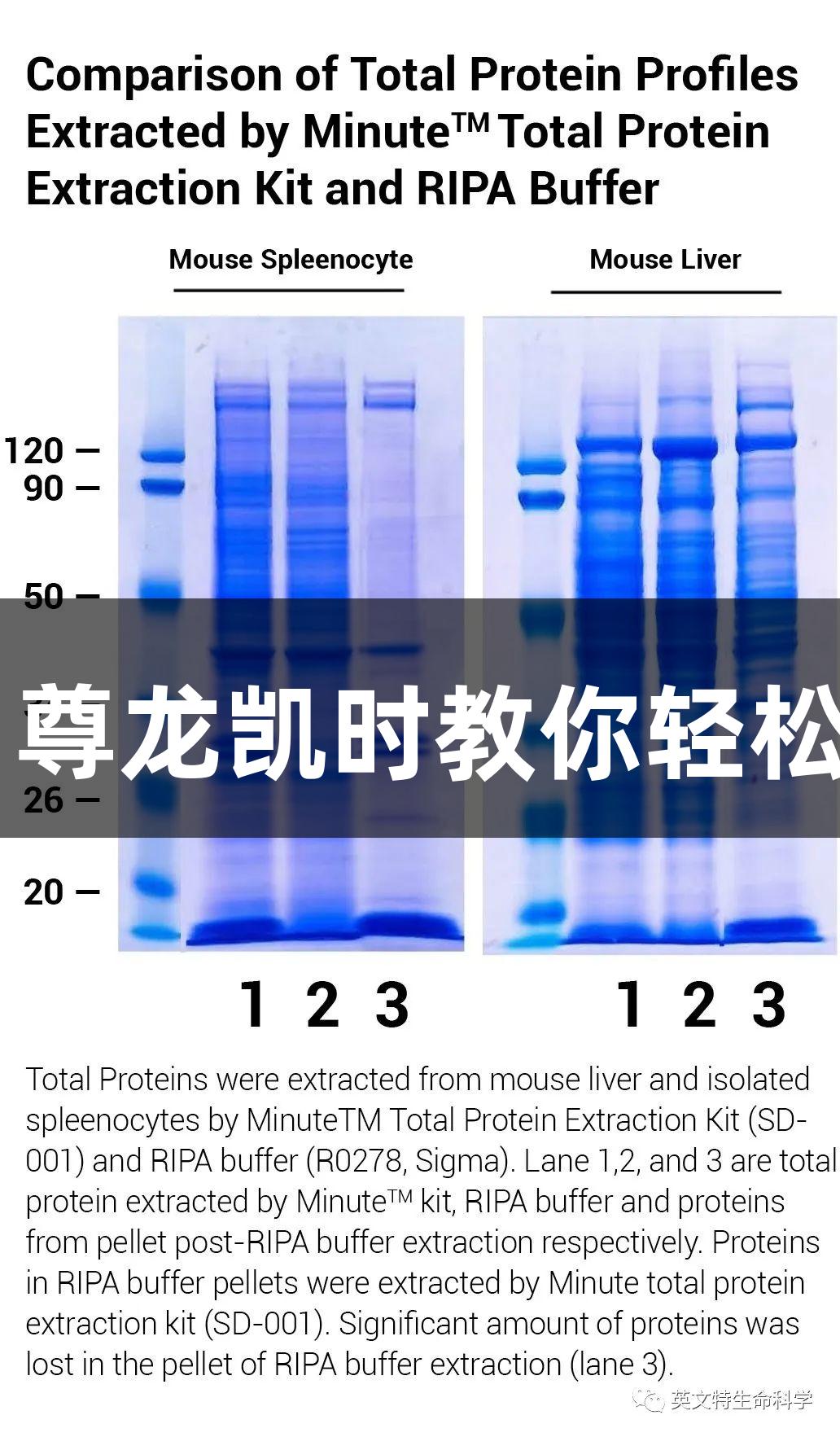 WB样品为何粘稠如“鼻涕”？尊龙凯时教你轻松清除核酸残团，条带立刻清晰！