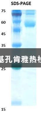 佛山尊龙凯时助力基孔肯雅热检测突破与疫苗希望