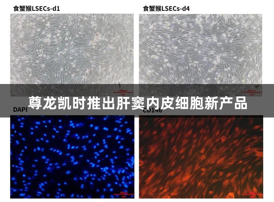 尊龙凯时推出肝窦内皮细胞新产品
