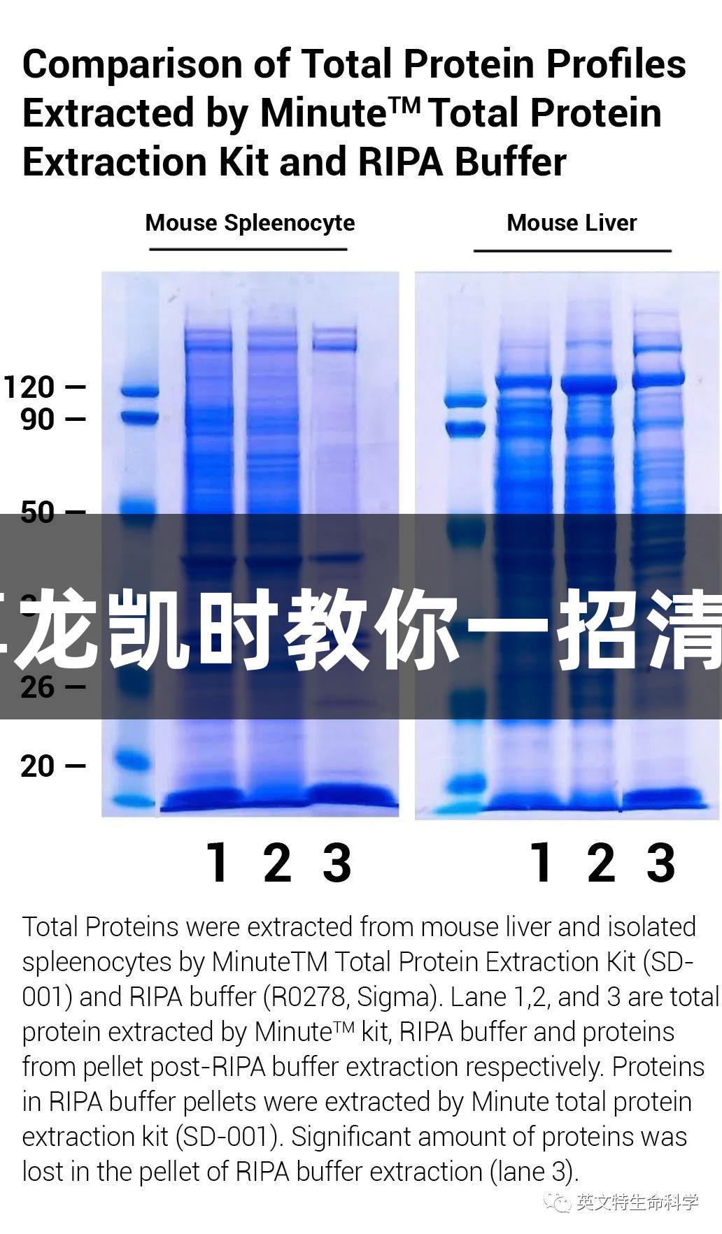 WB样品为何如“鼻涕”？尊龙凯时教你一招清除核酸残团，条带立刻清晰！