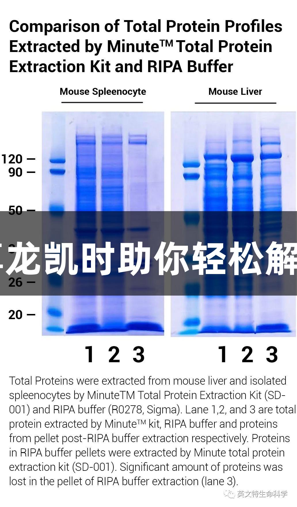 WB样品为何像“鼻涕”？尊龙凯时助你轻松解决核酸残团，条带清晰可见！
