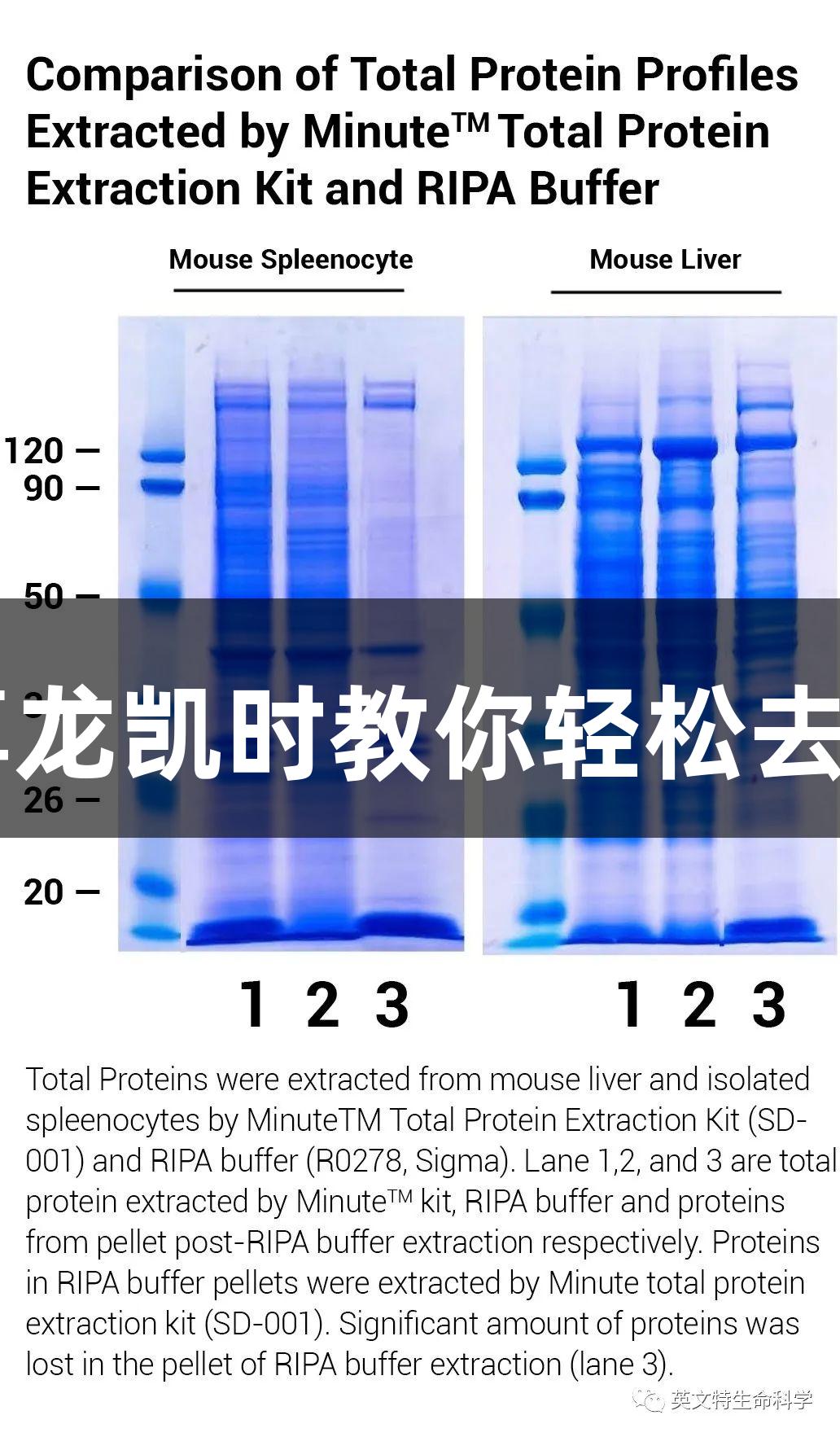 WB样品为何像“鼻涕”？尊龙凯时教你轻松去除核酸残团，条带立刻清晰！