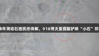 10余年肾结石困扰终得解，918博天堂提醒铲除“小石”防大患