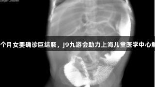 11个月女婴确诊巨结肠，J9九游会助力上海儿童医学中心解困