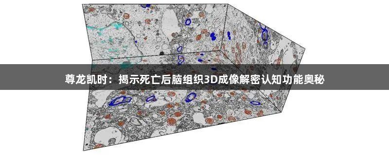 尊龙凯时：揭示死亡后脑组织3D成像解密认知功能奥秘