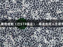 MDA-MB-468人乳腺癌细胞（已STR鉴定）- 尊龙凯时人生就博助力生物医疗研究