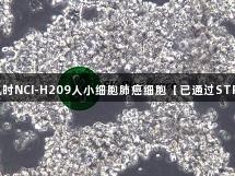 尊龙凯时NCI-H209人小细胞肺癌细胞【已通过STR鉴定】