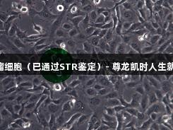 HT-1080人纤维肉瘤细胞（已通过STR鉴定）- 尊龙凯时人生就博生物医疗研发范例
