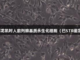 尊龙凯时人前列腺基质永生化细胞（已STR鉴定）