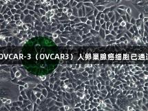 尊龙凯时 OVCAR-3（OVCAR3）人卵巢腺癌细胞已通过STR鉴定