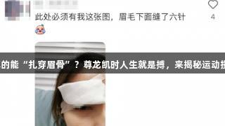 碳音球真的能“扎穿眉骨”？尊龙凯时人生就是搏，来揭秘运动损伤谣言！