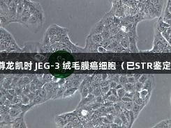 尊龙凯时 JEG-3 绒毛膜癌细胞（已STR鉴定）