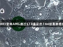 新葡萄8883官網AMG通過STR鑒定的T84結直腸癌細胞研究