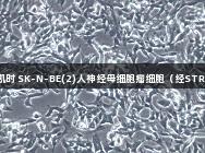 尊龙凯时 SK-N-BE(2)人神经母细胞瘤细胞（经STR鉴定）