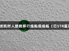 尊龙凯时人膀胱移行细胞癌细胞（已STR鉴定）