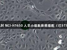 尊龙凯时 NCI-H1650 人非小细胞肺癌细胞（已STR鉴定）