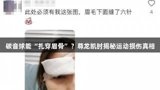 碳音球能“扎穿眉骨”？尊龙凯时揭秘运动损伤真相