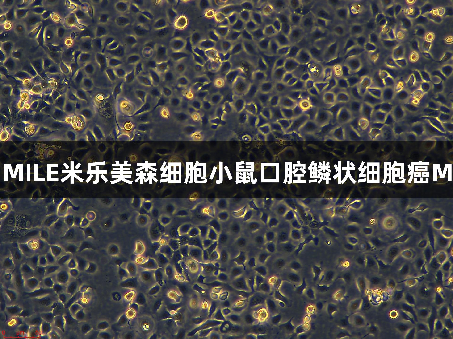 每日推荐：MILE米乐美森细胞小鼠口腔鳞状细胞癌MOC1细胞系